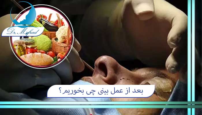 بعد از عمل بینی چی بخوریم؟