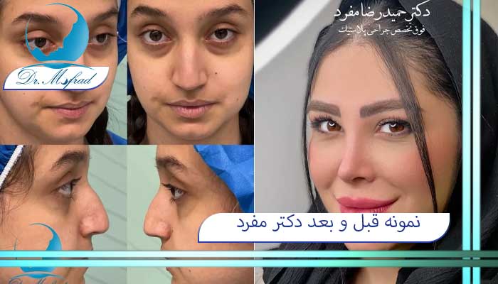 بهترین دکتر و جراح بینی در تهران