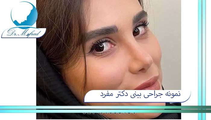 بهترین دکتر جراح بینی در تهران