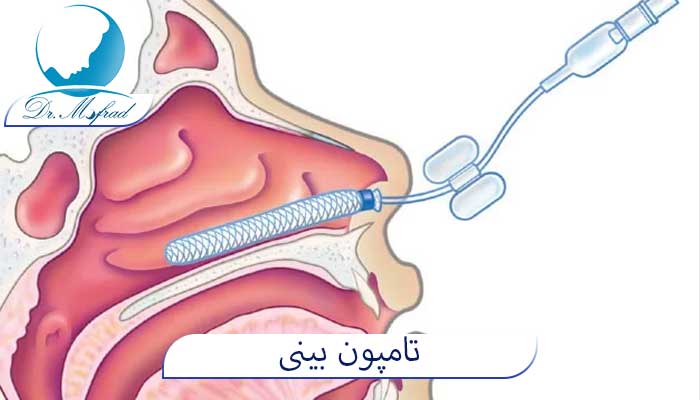 کاربرد تامپون چیست؟