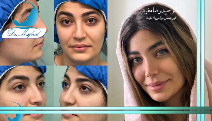 نمونه کار قبل و بعد دکتر مفرد