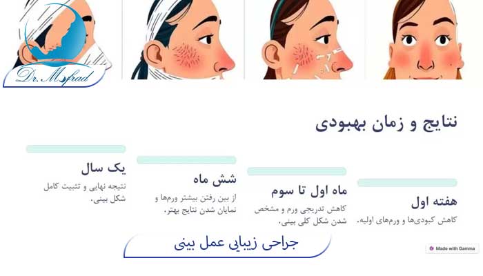 جراحی بینی و دوره ی نقاهت