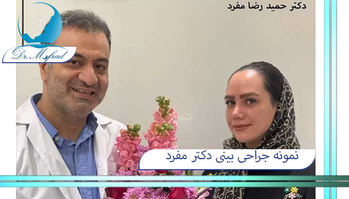 نمونه ی جراحی بینی دکتر حمید رضا مفرد