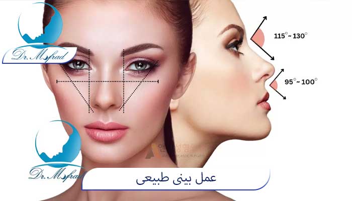عمل بینی طبیعی در تهران
