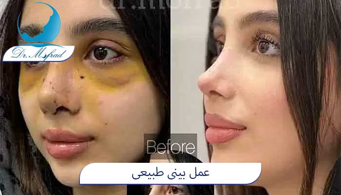 عمل طبیعی و نچرال در تهران