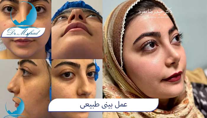 عمل طبیعی شبک 