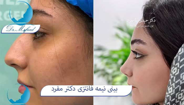 دکتر جراح بینی نیمه فانتزی