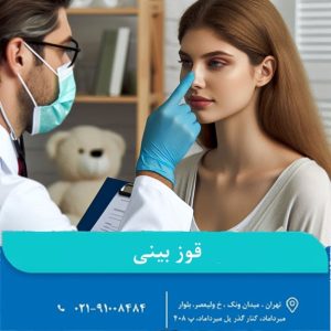 قوز بینی