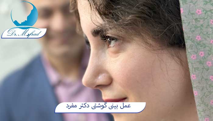 عمل بینی گوشتی