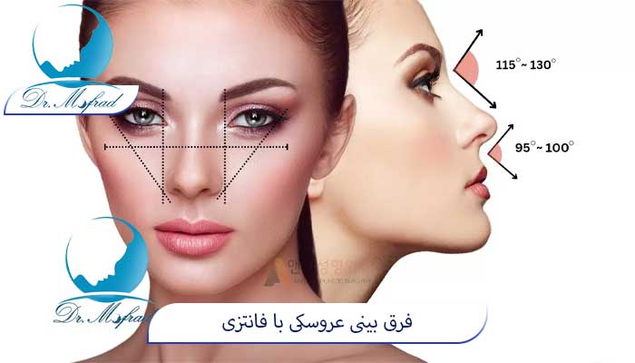 ویژگی‌های اصلی عمل بینی فانتزی عروسکی
