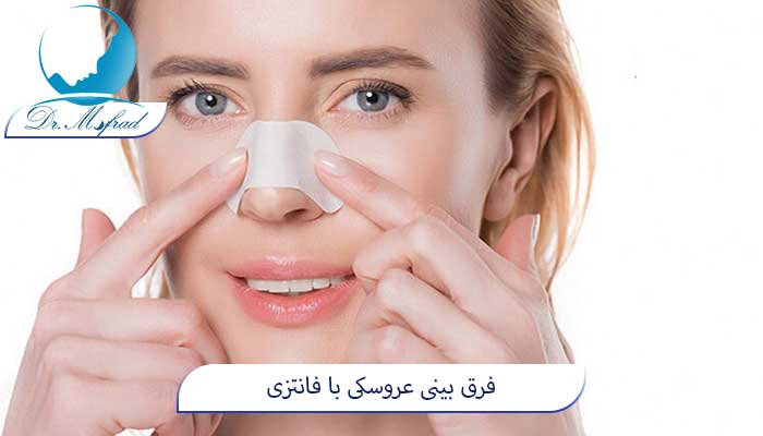 کدام مدل بینی طبیعی‌تر به نظر می‌رسد؟