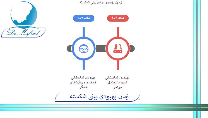 زمان بهبودی برای بینی شکسته