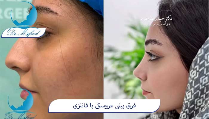 عمل بینی فانتزی چیست؟