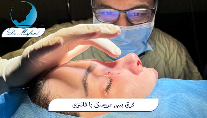 فرق بینی عروسکی با فانتزی