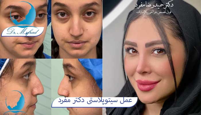 سیتوپلاستی دکتر حمید رضا