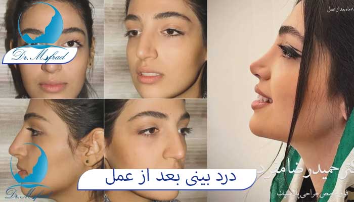 عفونت ، علت درد بعد از عمل بینی
