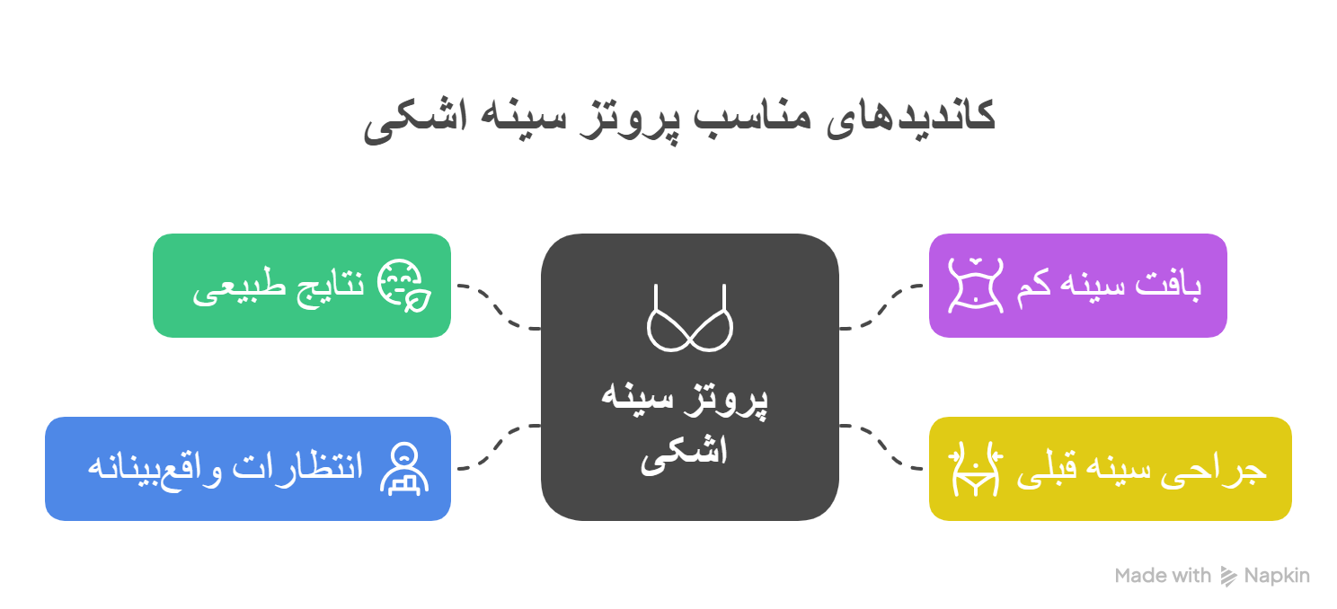 پروتز