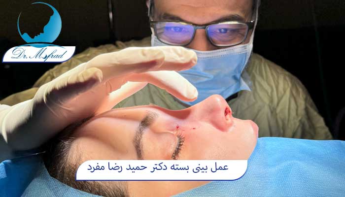 عمل بینی بسته 