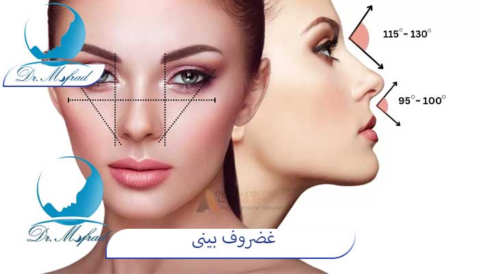 غضروف بینی