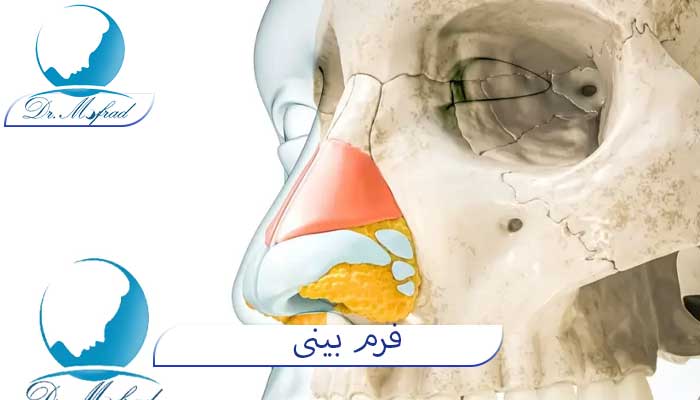 انواع فرم بینی