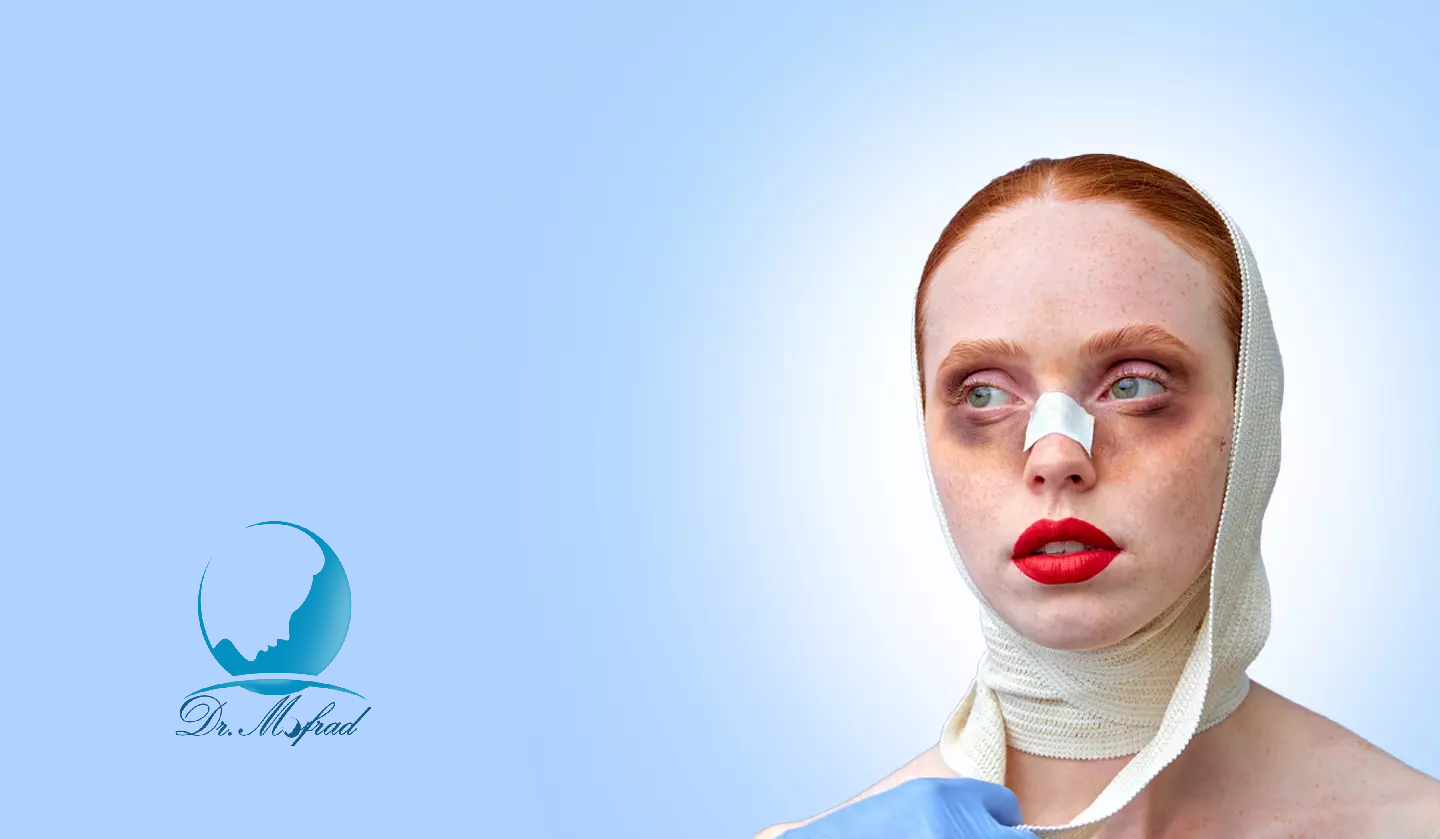 کبودی عمل بینی