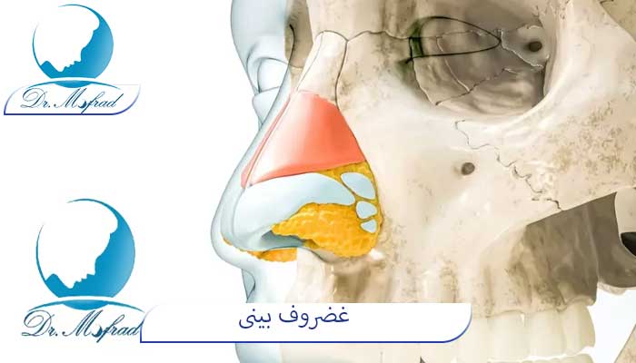 غضروف بینی