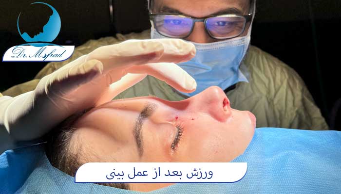 ورزش بعد از عمل بینی