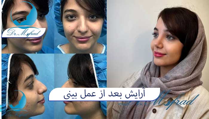 انتخاب محصولات آرایشی مناسب پوست حساس