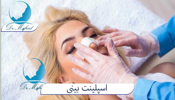 مدت زمان استفاده از اسپلینت بینی