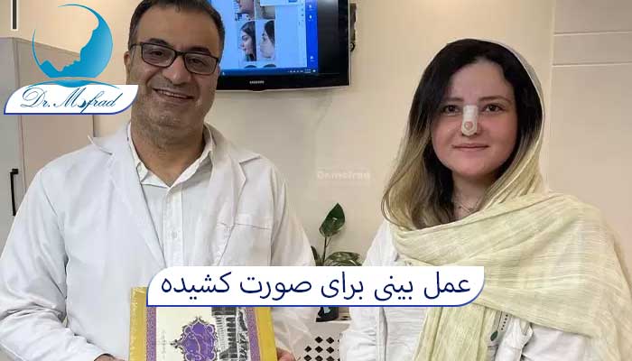 مزایای عمل بینی برای صورت کشیده