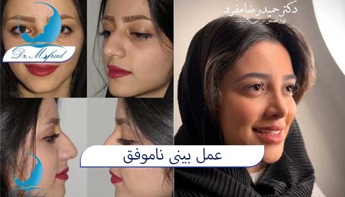 نقش تجربه جراح در موفقیت عمل بینی