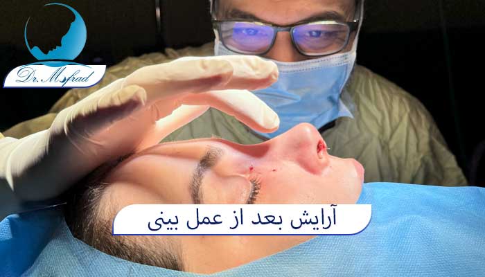 آرایش بعد از عمل بینی