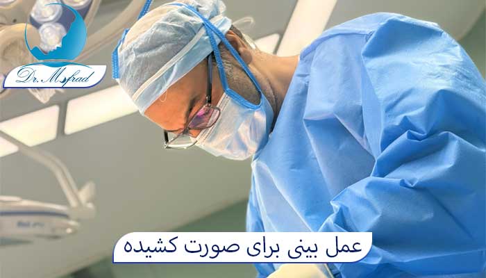 عمل بینی برای صورت کشیده