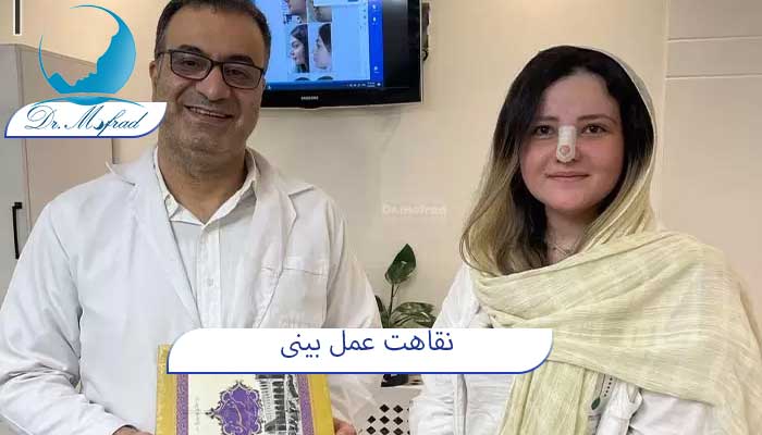 نقاهت عمل بینی