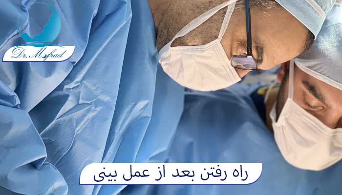 راه رفتن بعد از عمل بینی