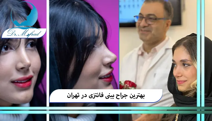 بهترین جراح بینی فانتزی در تهران