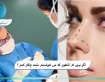 اگر بینی ام آنطور که می خواستم نشد چکار کنم؟