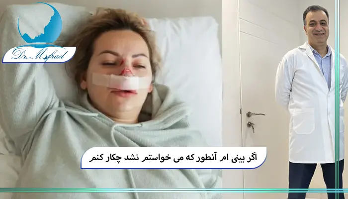 راهکارهای اصلاح بینی خراب شده پس از عمل