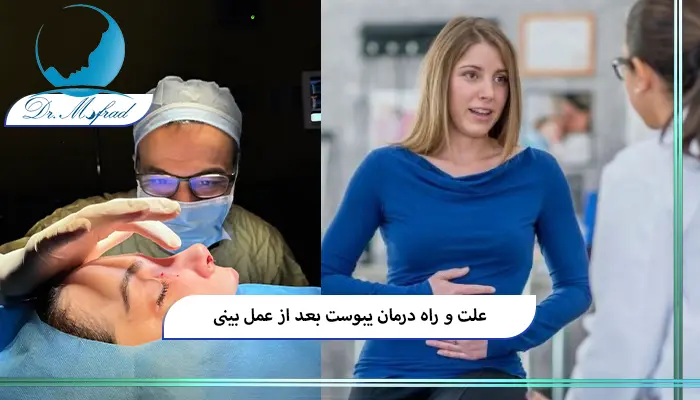 درمان یبوست بعد ازجراحی بینی