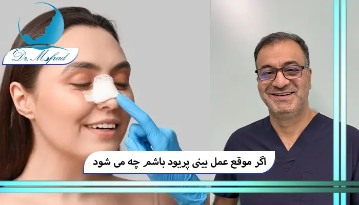 عمل بینی هنگام پریودی