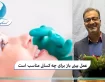 عمل بینی باز برای چه کسانی مناسب است؟
