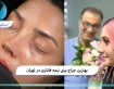 بهترین جراح بینی نیمه فانتزی در تهران