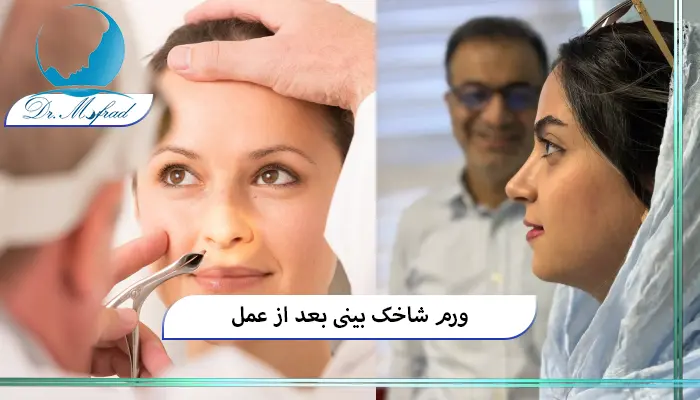 علائم بزرگی شاخک‌های بینی