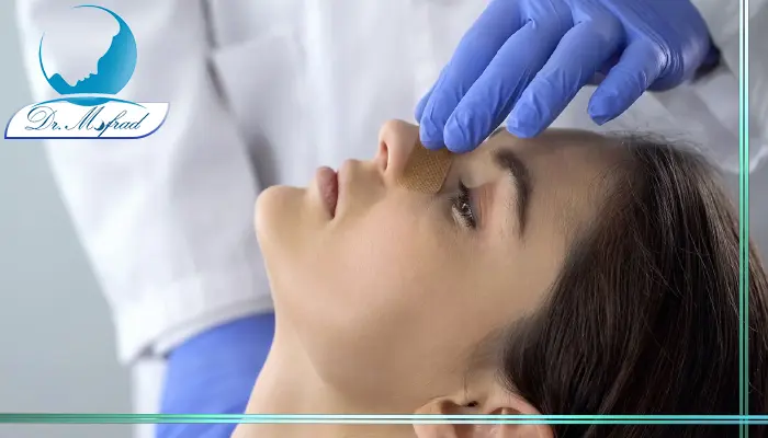 عمل بینی طبیعی یا نیمه فانتزی به روش بسته