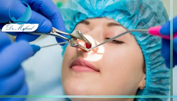 مقایسه عوارض عمل بینی طبیعی و نیمه فانتزی