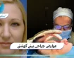 عوارض جراحی بینی گوشتی