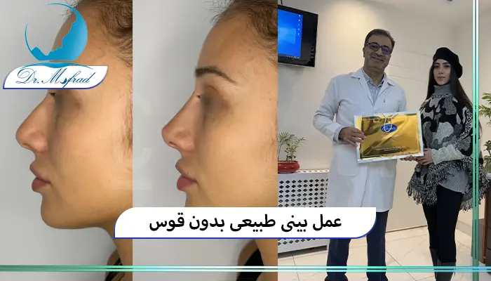 عمل بینی طبیعی چگونه است؟