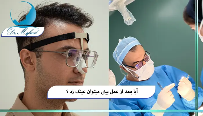 بعد از عمل بینی چه عينکی بزنیم؟