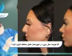 آیا هزینه عمل بینی در شهرستان های مختلف فرق دارد؟