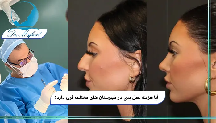 هزینه جراحی بینی در شهرهای مختلف